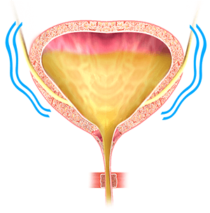 cns17