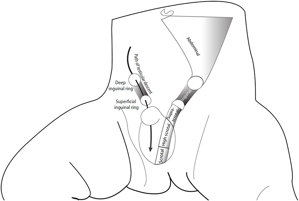 cns33